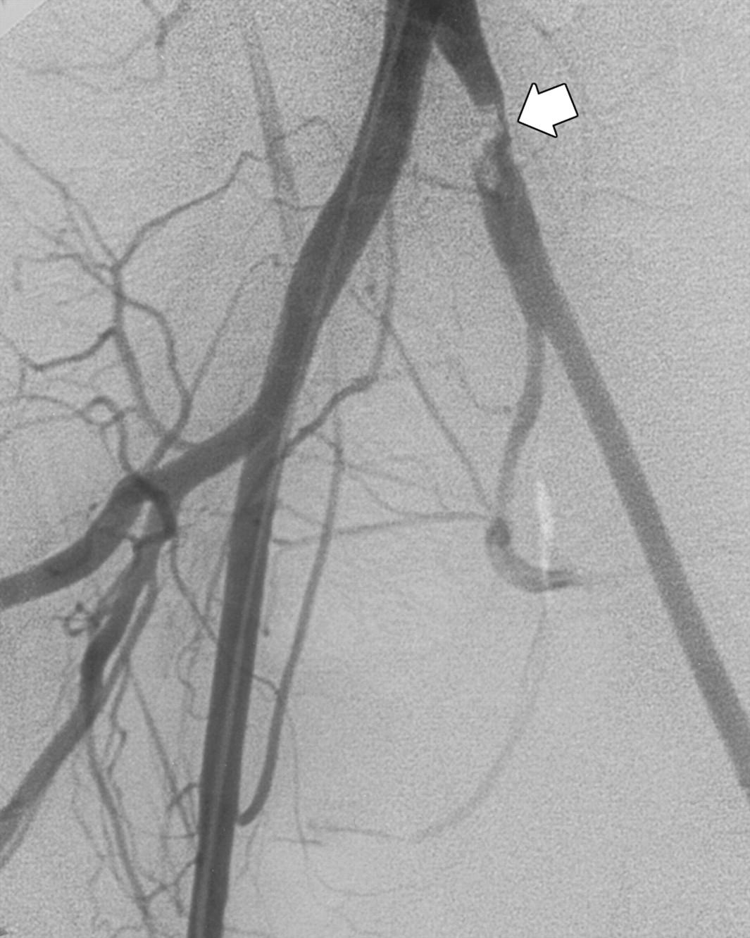 images_04_ac0626_03b