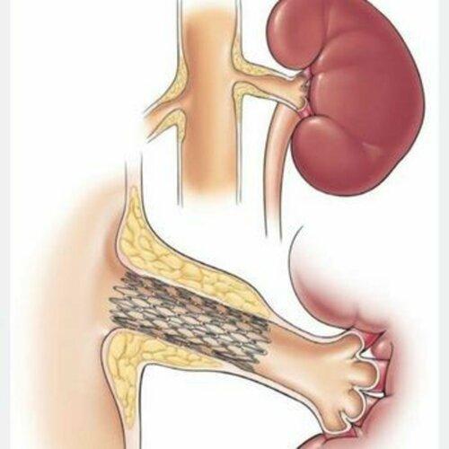 33866661645c5dae90cde3655e90f2d70fafc81e63c9158f25b41