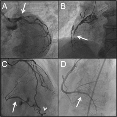 1-s2.0-S1553838918303245-gr1