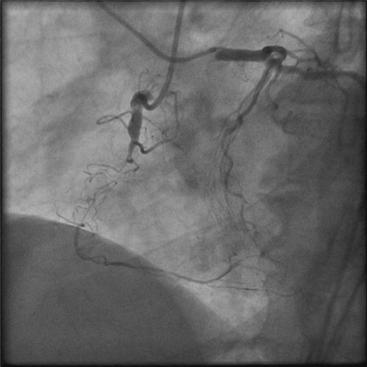 B9780323080576000100_f10-03-9780323080576