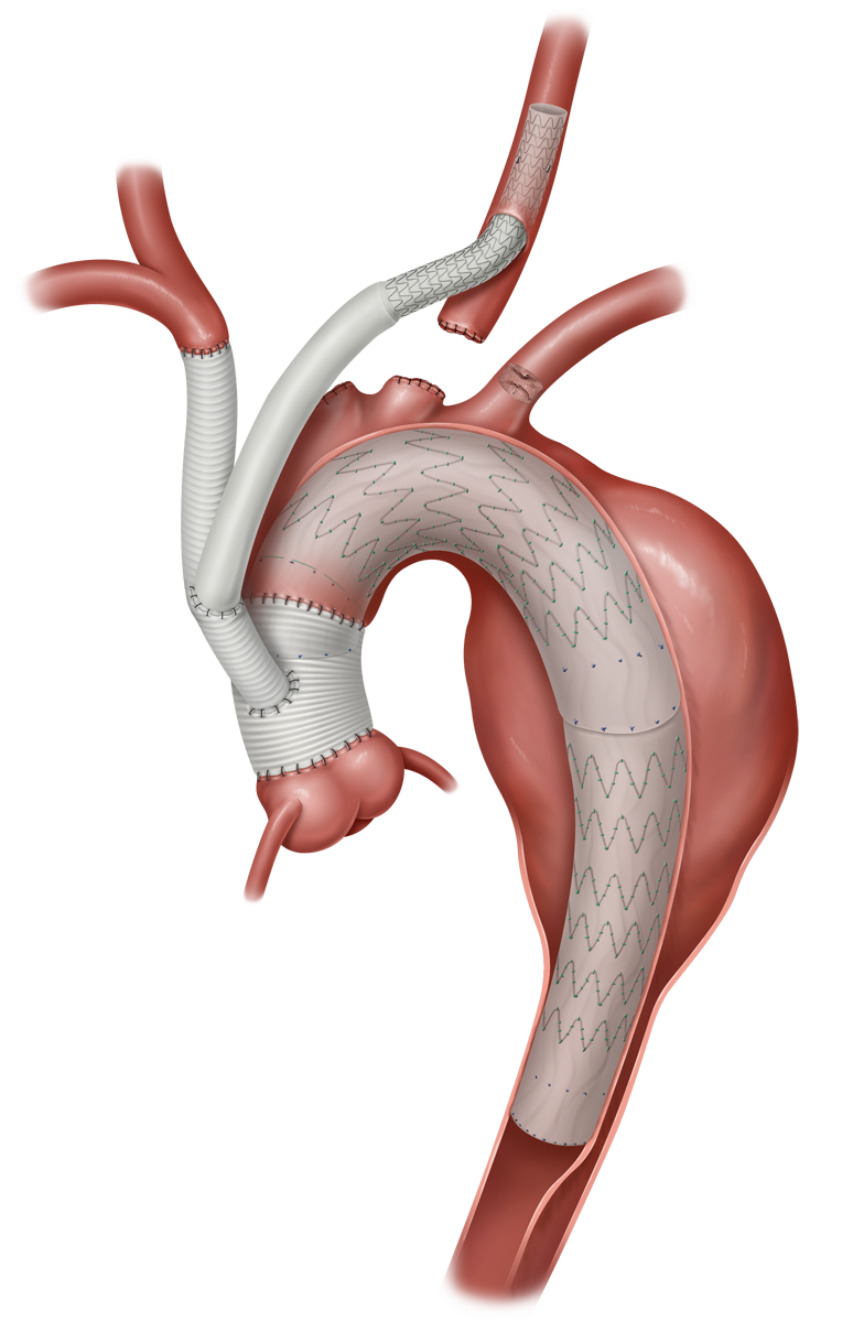 a7ee2e_2db730b708c84d3398837c6a34aa2fcd