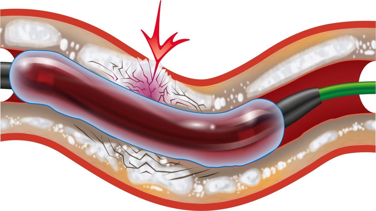APPA7BOSZFL4VLUZ77TC25RT2M