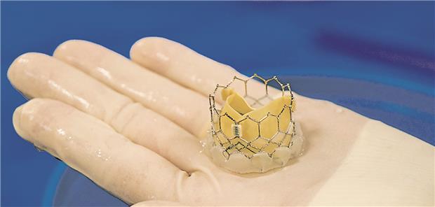 Die-TAVI-zaehlt-inzwischen-zum-Goldstandard-der-Therapie-211240