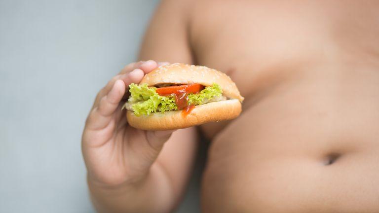 skynews-obesity-obese-hamburger_4655730