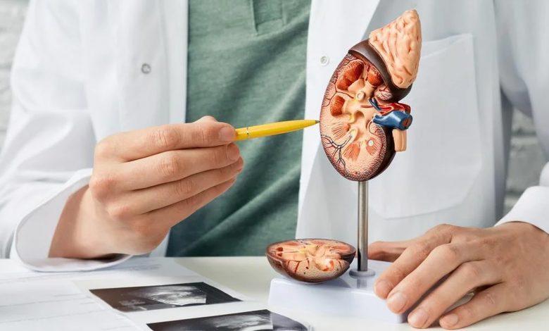 PIC-SAMPLE-7-780x470