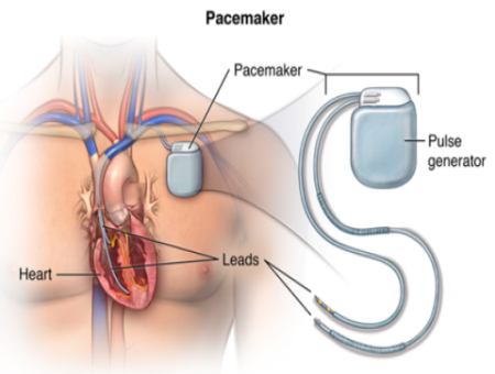 thumbnail_ae97ca0716