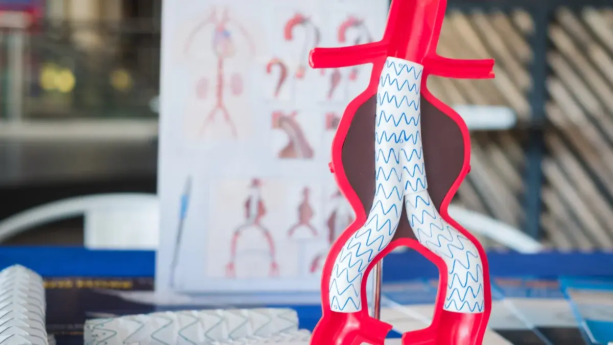 درمان آنوریسم آئورت (EVAR - TEVAR)