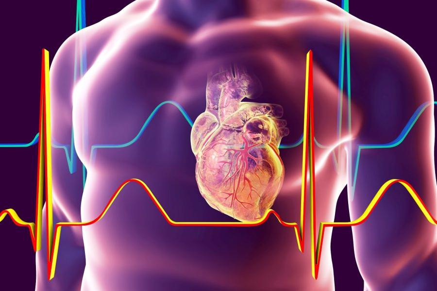 آریتمی‌ های قلبی