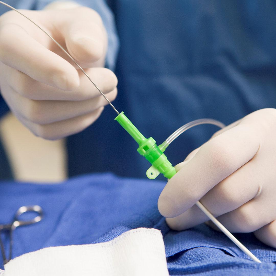 مراقبت‌های قبل از آنژیوگرافی قلب