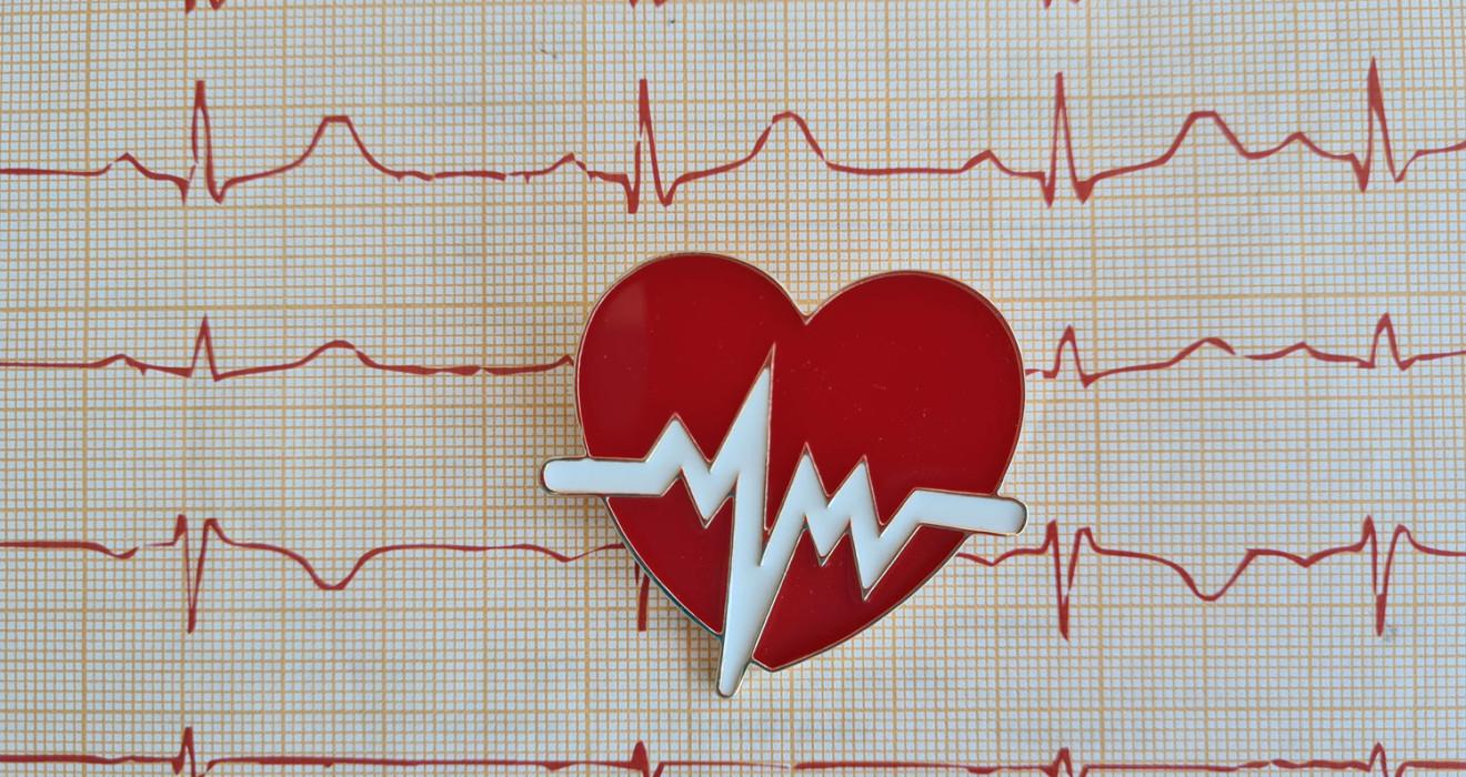 نوار قلب (الکتروکاردیوگرام)