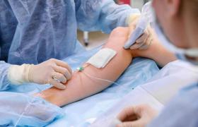 مراقبت‌های قبل از لیزر داخل عروقی واریس (EVLA)