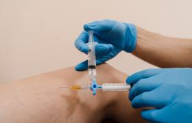 مراقبت‌های بعد از اسکلروتراپی