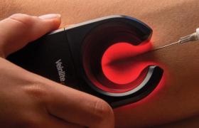 مراقبت‌های قبل از اسکلروتراپی